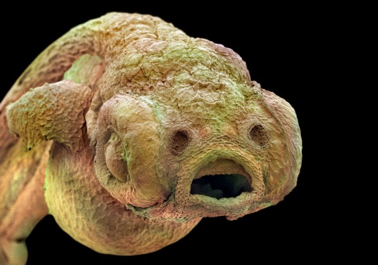 Embryonic Zebrafish