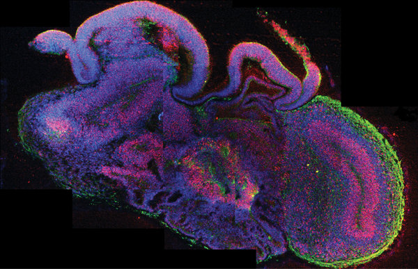 Human Brain Organoid image