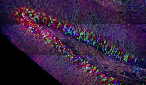 Neurons in the adult mouse hippocampus