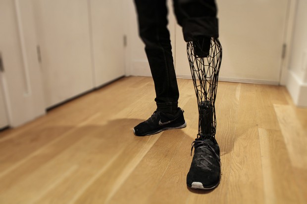 exo_3d_printed_prosthetic_leg