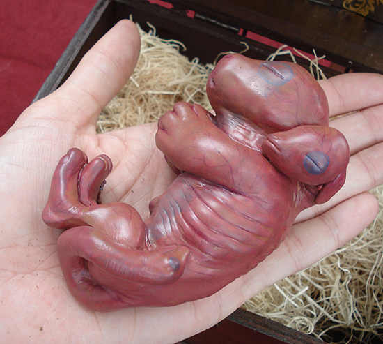 Chimera-fetus