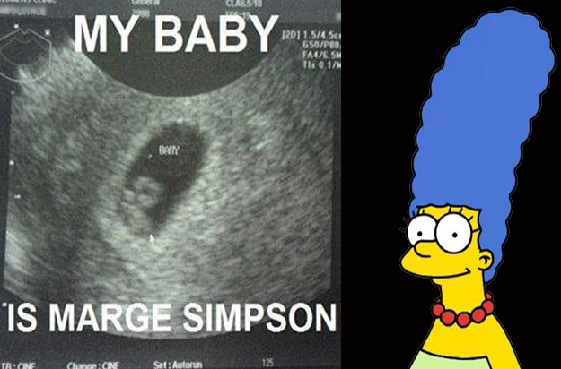 Marge Simpson ultrasound