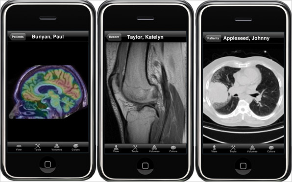 Apple iPhone health data