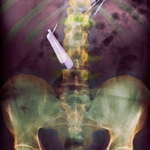 Scissors x-ray - Walyou